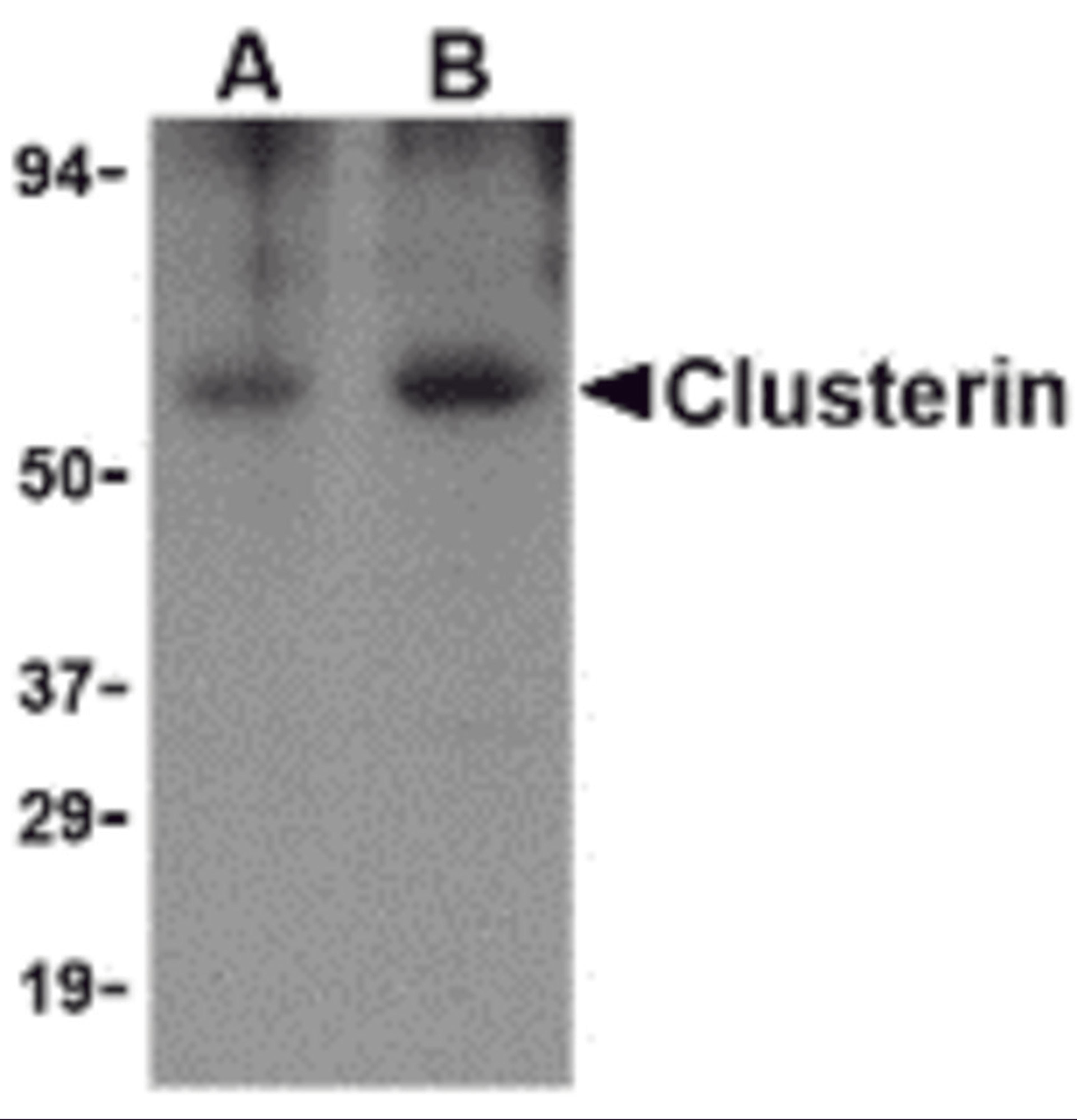 Western blot analysis of Clusterin in human brain tissue lysate with Clusterin body at (A) 0.5 and (B) 1 μg/mL.