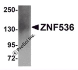 Western blot analysis of ZNF536 in human brain tissue lysate with ZNF536 antibody at 1 &#956;g/mL.