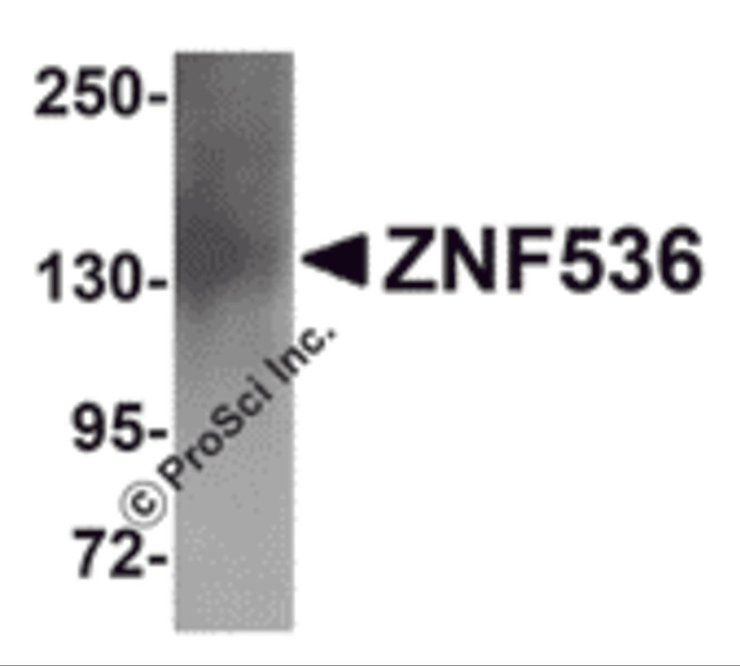 Western blot analysis of ZNF536 in human brain tissue lysate with ZNF536 antibody at 1 μg/mL.