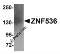 Western blot analysis of ZNF536 in human brain tissue lysate with ZNF536 antibody at 1 μg/mL.