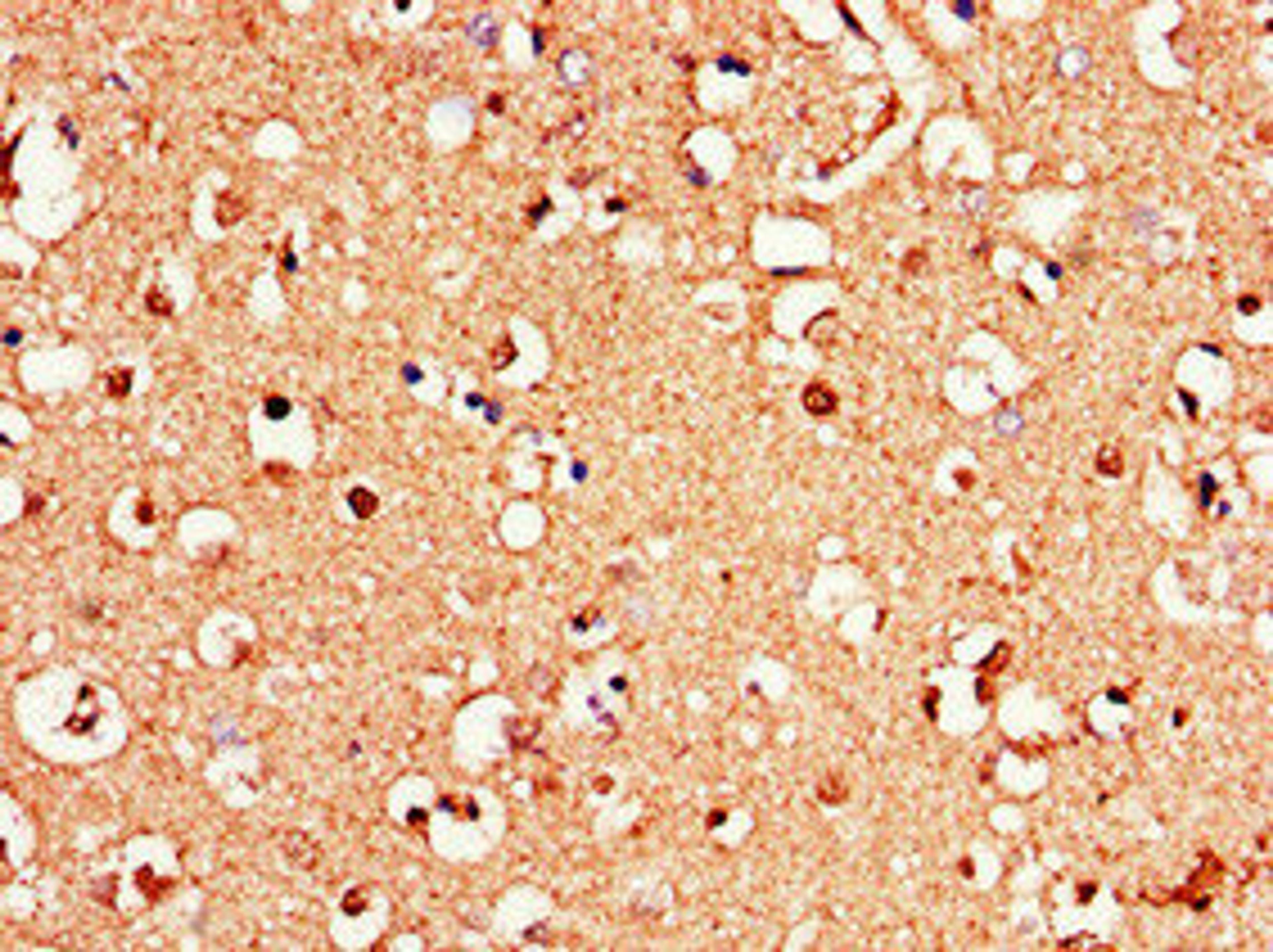 Immunohistochemistry of paraffin-embedded human brain tissue using CSB-PA009931LA01HU at dilution of 1:100