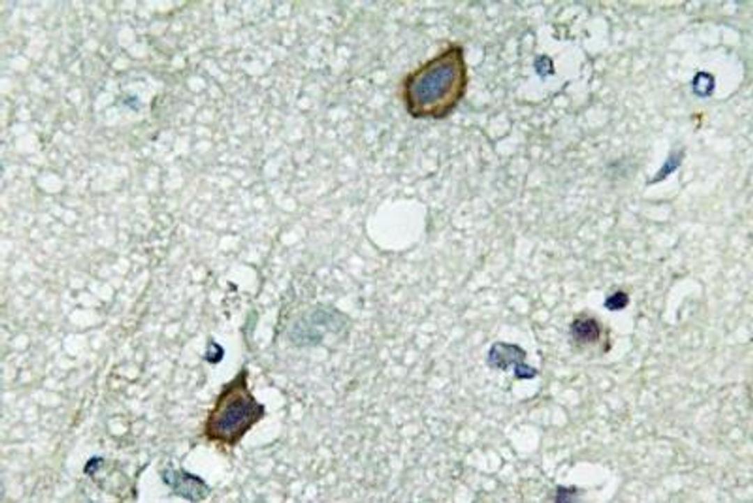 Immunohistochemistry-Paraffin: Connexin 45/GJC1 Antibody [NBP1-30531] - Human brain tissue.