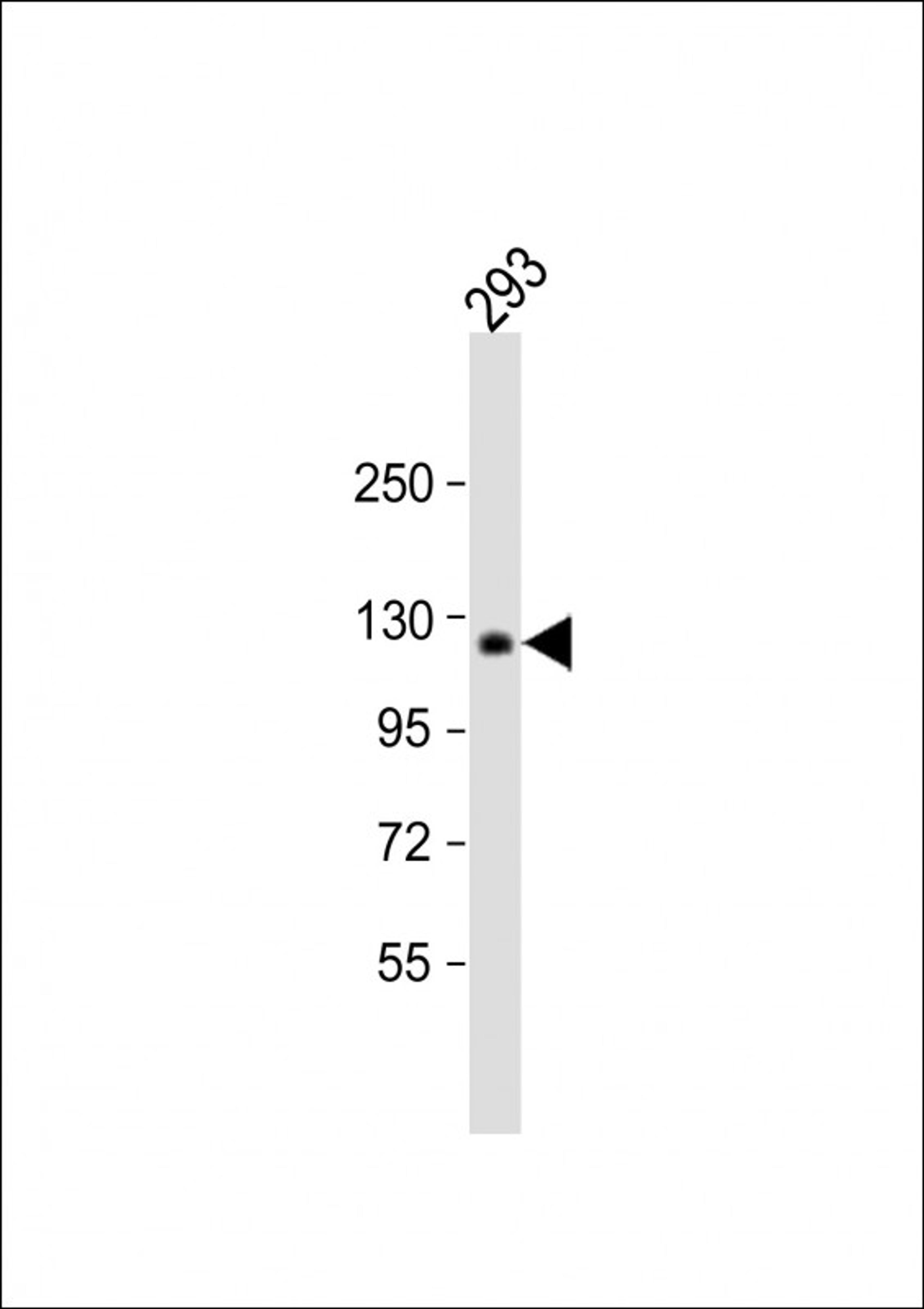 Western Blot at 1:1000 dilution + 293 whole cell lysate Lysates/proteins at 20 ug per lane.