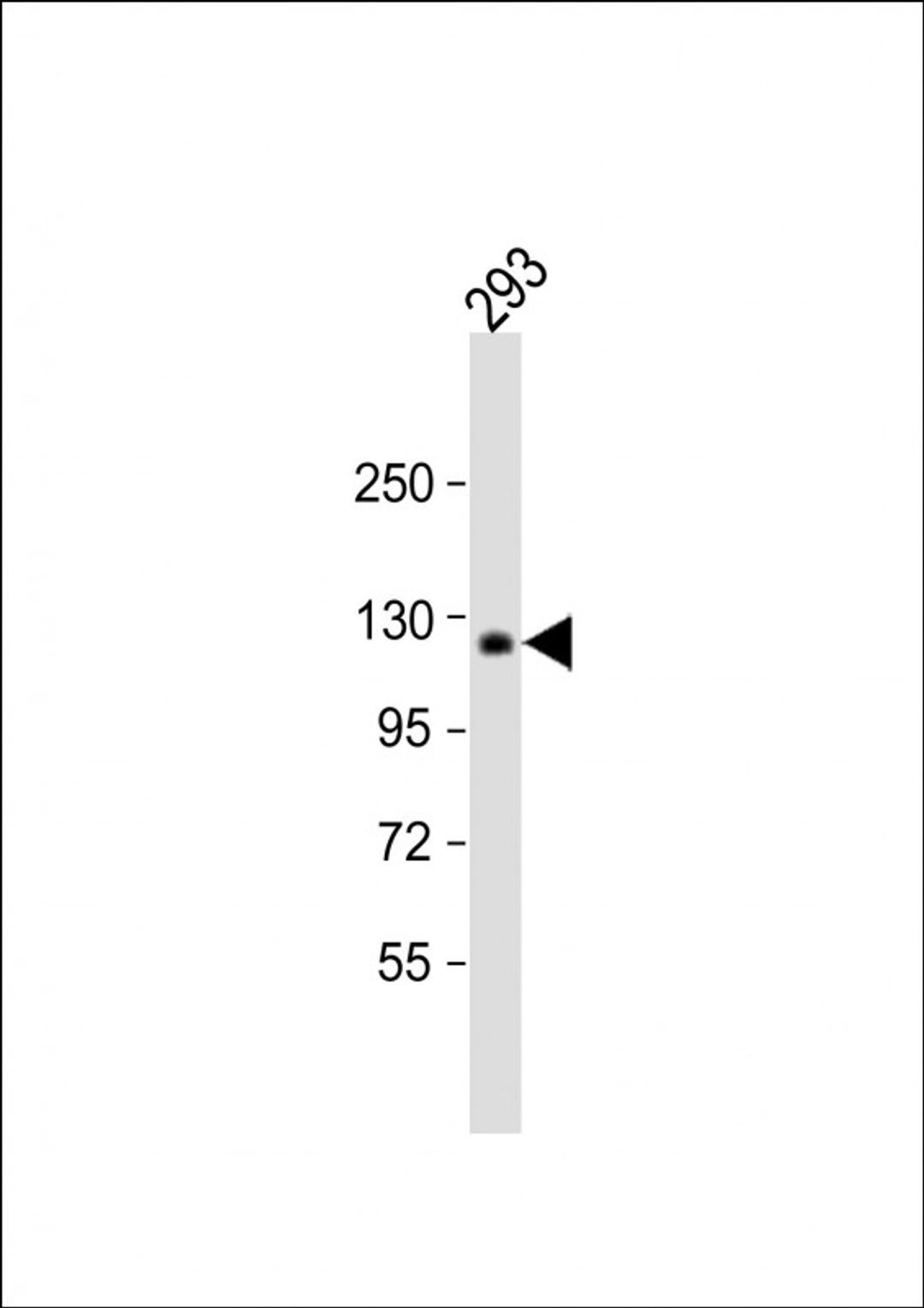 Western Blot at 1:1000 dilution + 293 whole cell lysate Lysates/proteins at 20 ug per lane.