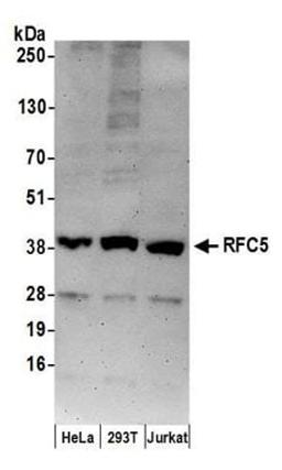 Detection of human RFC5 by western blot.