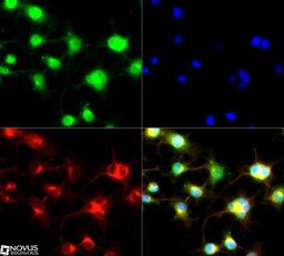 Immunocytochemistry/Immunofluorescence: Capicua Antibody [NB110-59906] - Capicua antibody was tested in Neuro 2A cells with DyLight 488 (green). Nuclei and alpha-tubulin were counterstained with DAPI (blue) and Dylight 550 (red).