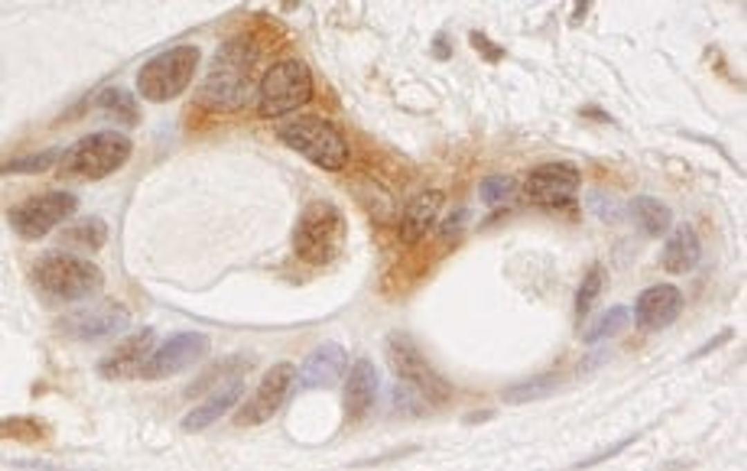 Detection of human OSR1 by immunohistochemistry.