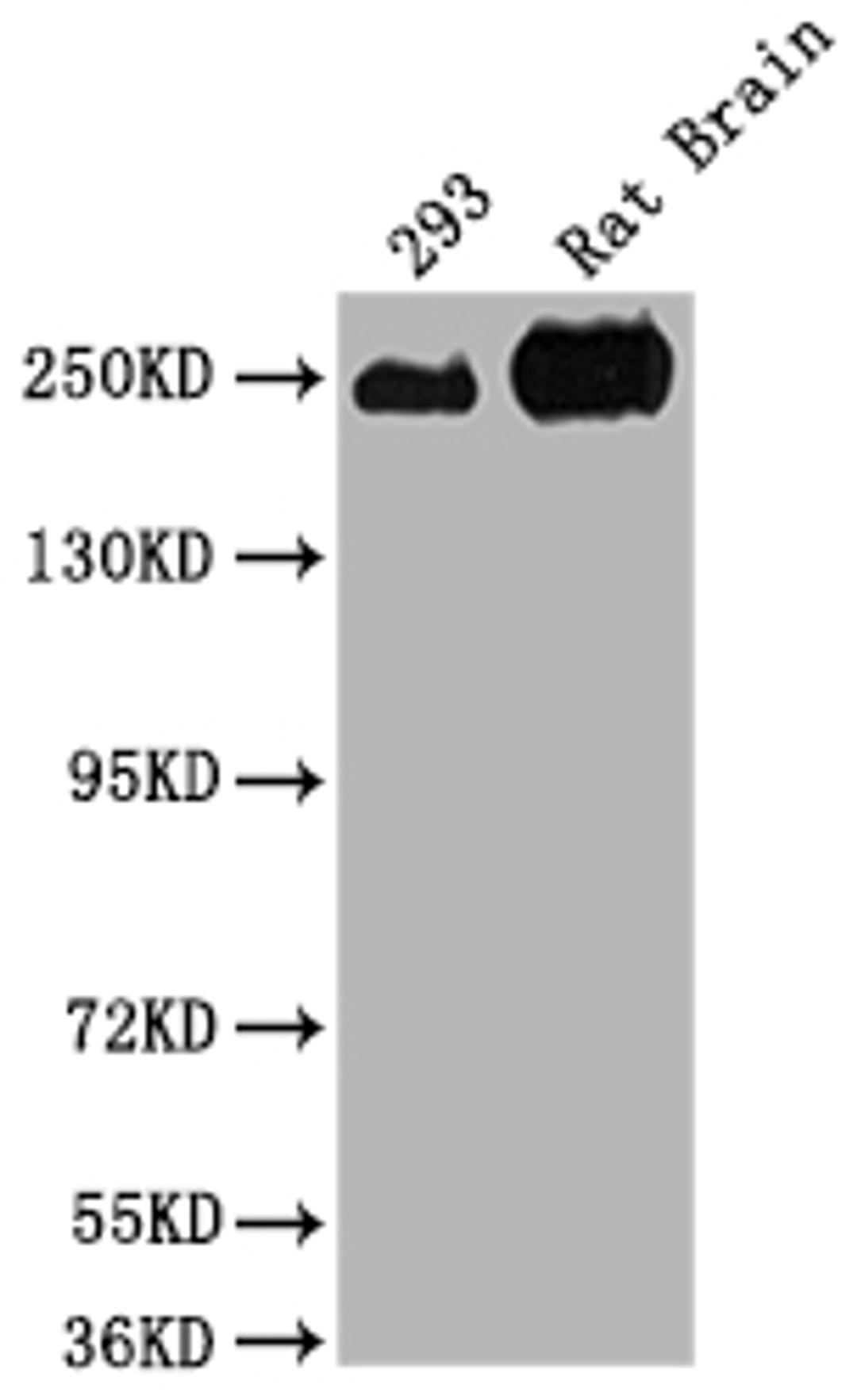 Western Blot. Positive WB detected in: 293 whole cell lysate, Rat Brain tissue. All lanes: MYH10 antibody at 1:2000. Secondary. Goat polyclonal to rabbit IgG at 1/50000 dilution. Predicted band size: 229, 231, 232, 233 kDa. Observed band size: 250 kDa. 