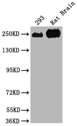 Western Blot. Positive WB detected in: 293 whole cell lysate, Rat Brain tissue. All lanes: MYH10 antibody at 1:2000. Secondary. Goat polyclonal to rabbit IgG at 1/50000 dilution. Predicted band size: 229, 231, 232, 233 kDa. Observed band size: 250 kDa. 