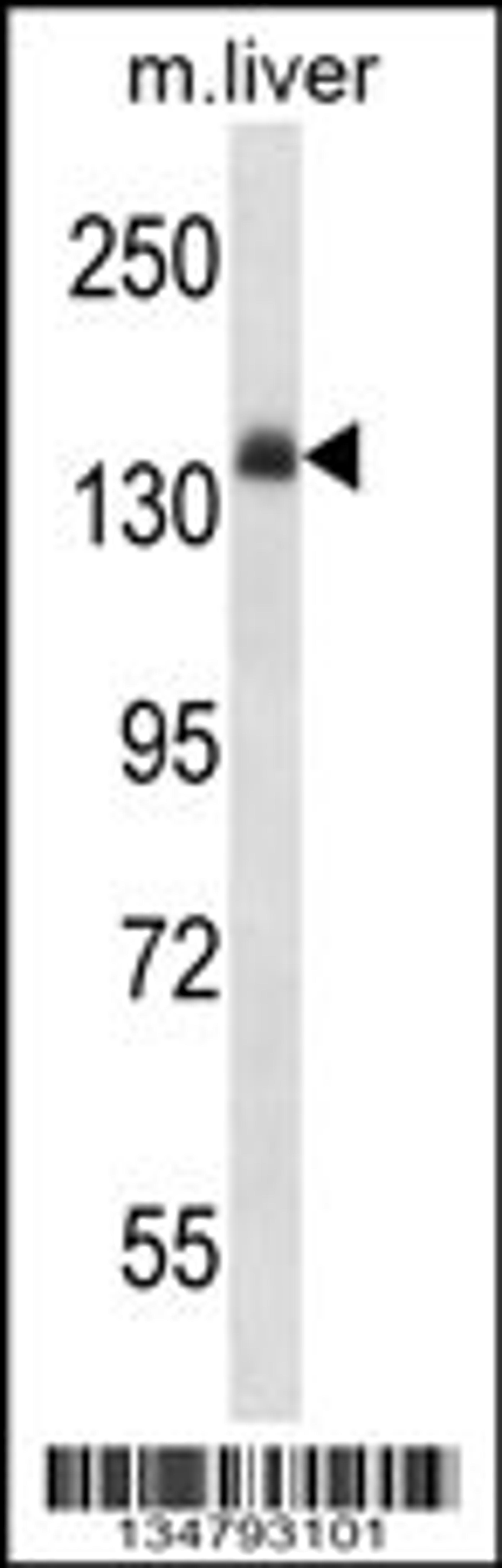 Western blot analysis in mouse liver tissue lysates (35ug/lane).