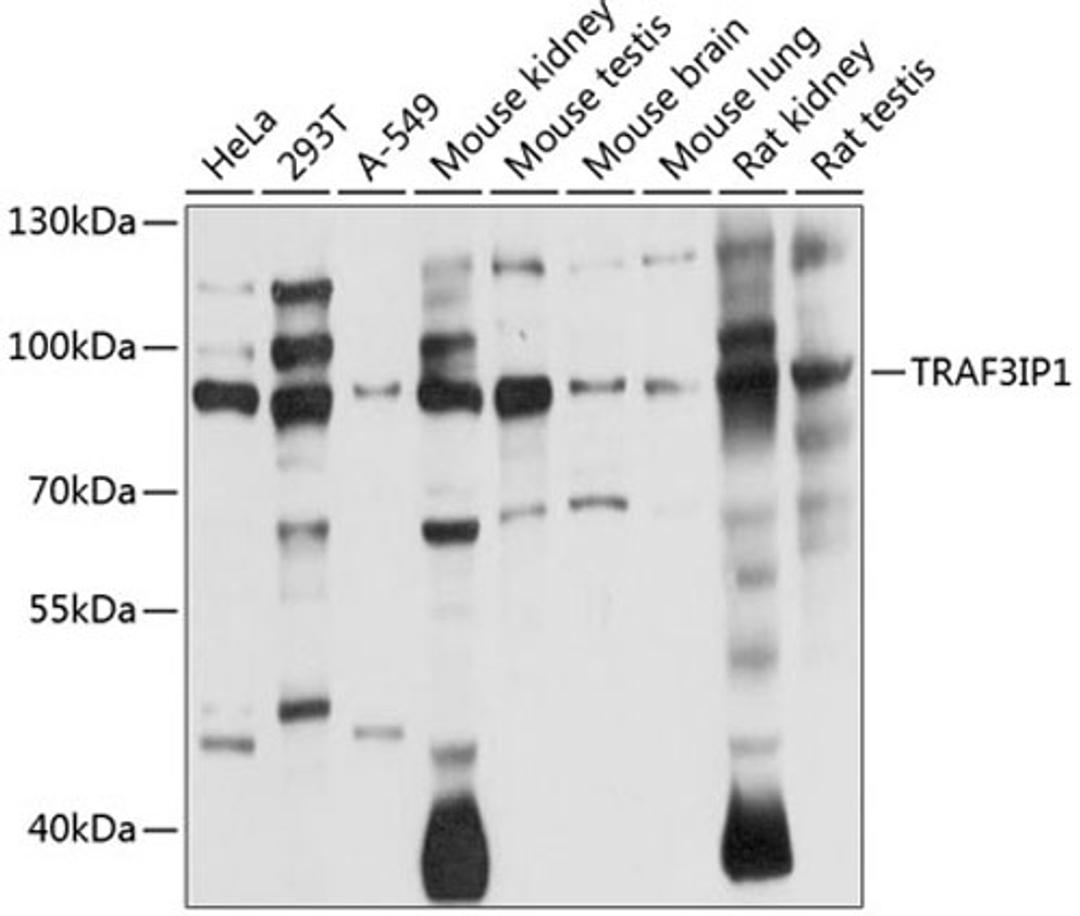 Western blot - TRAF3IP1 antibody (A8997)