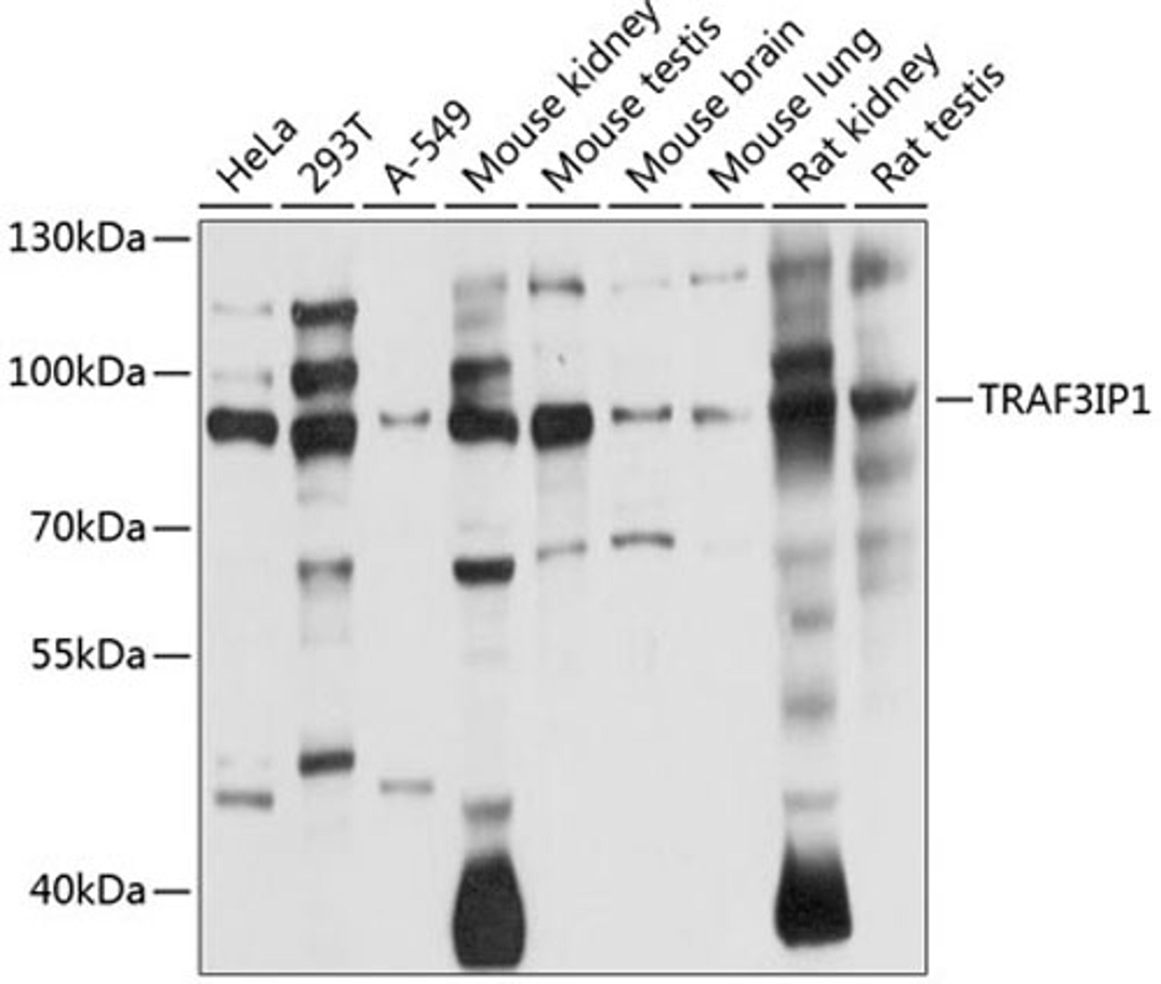 Western blot - TRAF3IP1 antibody (A8997)