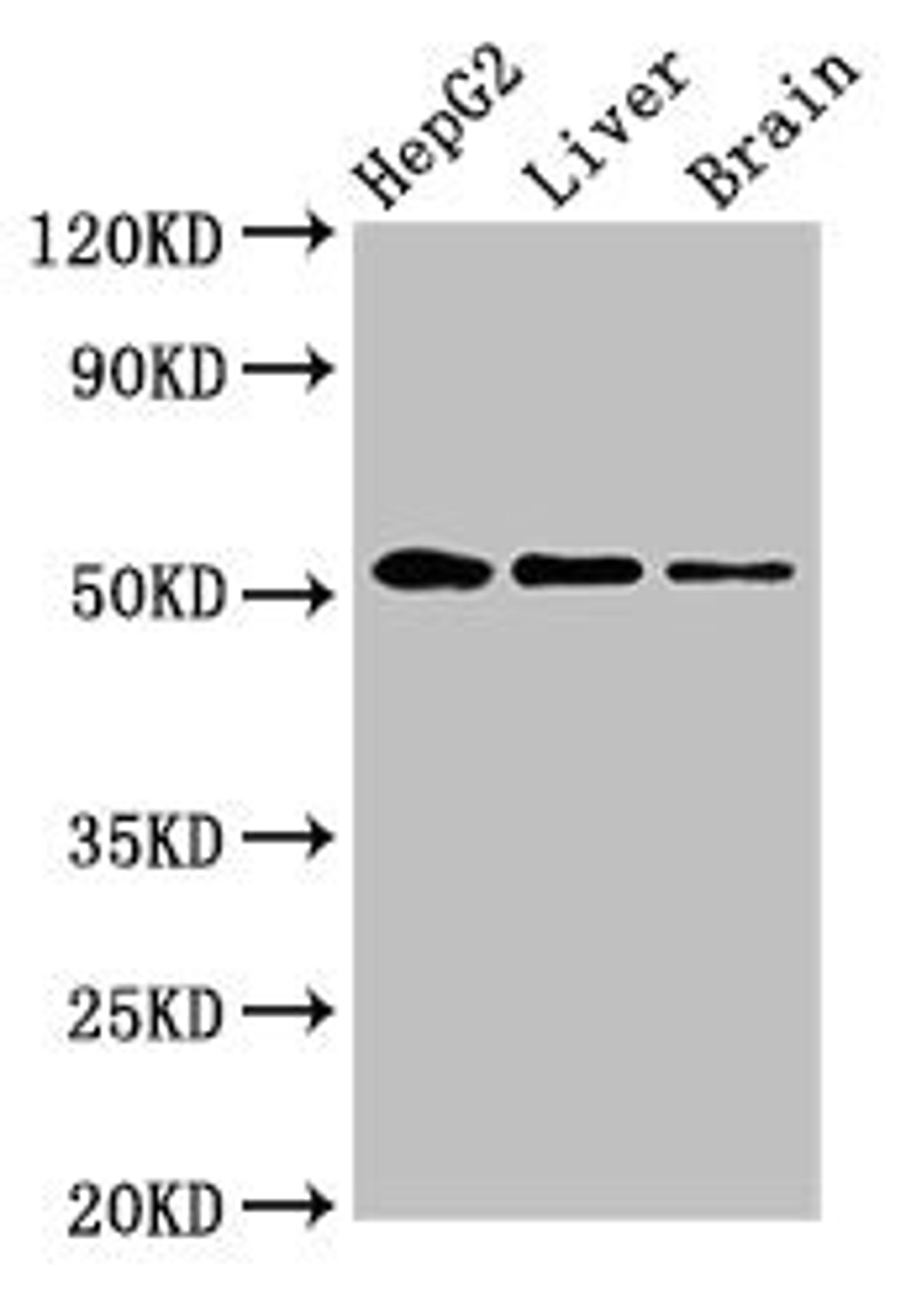 Western Blot. Positive WB detected in: HepG2 whole cell lysate, Rat liver tissue, Rat brain tissue. All lanes: EGR2 antibody at 3.4ug/ml. Secondary. Goat polyclonal to rabbit IgG at 1/50000 dilution. Predicted band size: 51, 45 kDa. Observed band size: 51 kDa. 
