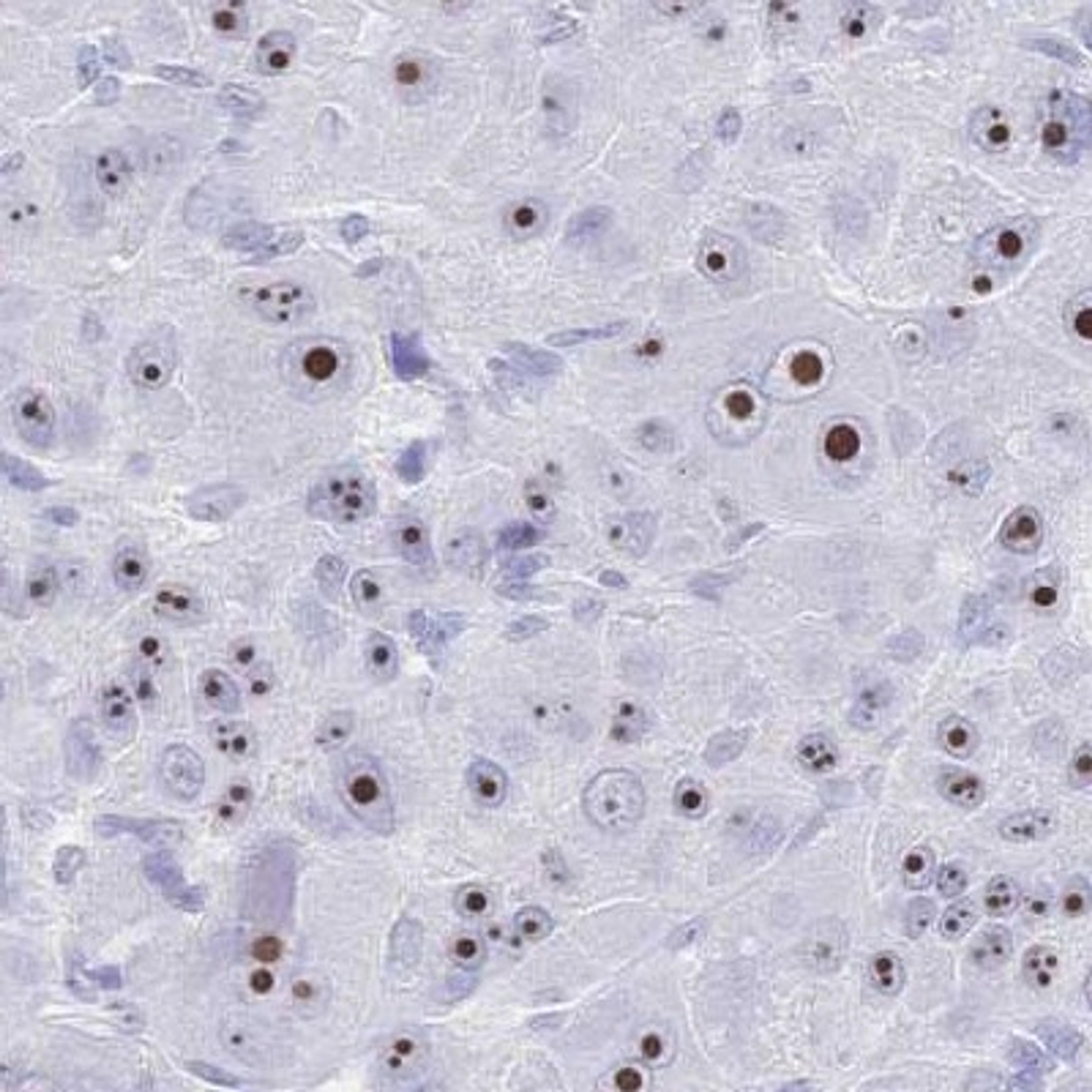 Immunohistochemistry: SCGB1D4 Antibody [NBP2-32549] - liver cancer