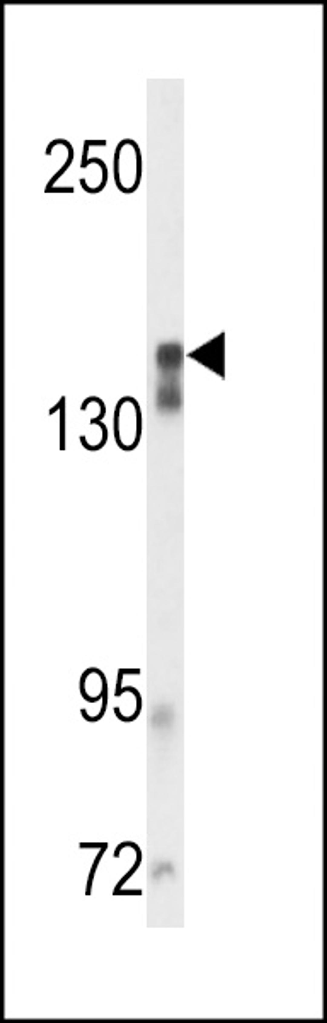 Western blot analysis of VGFR2 Antibody in mouse cerebellum tissue lysates (35ug/lane)