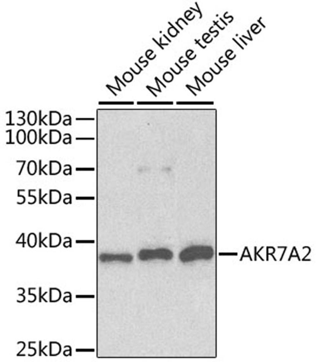 Western blot - AKR7A2 antibody (A1227)