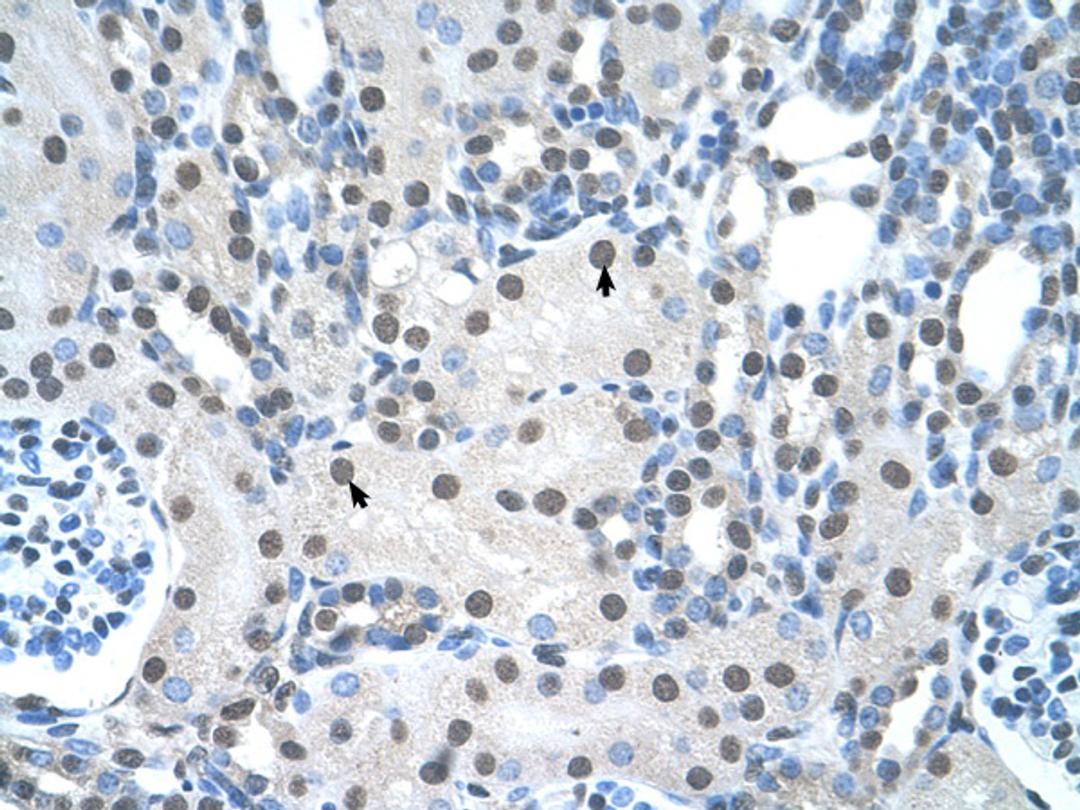 Antibody used in IHC on Human kidney.