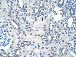 Antibody used in IHC on Human kidney.