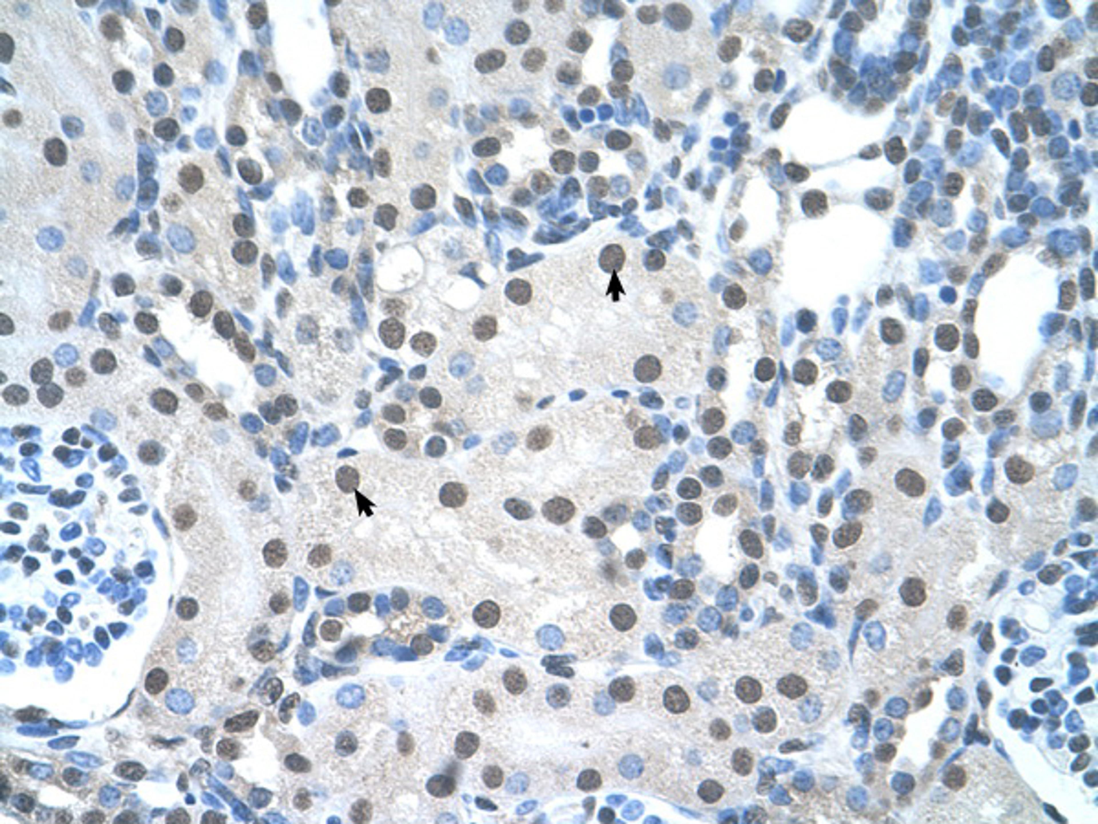 Antibody used in IHC on Human kidney.