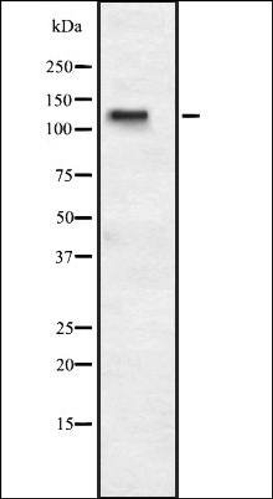 Western blot analysis of HEK293 cells using ASPP1 antibody