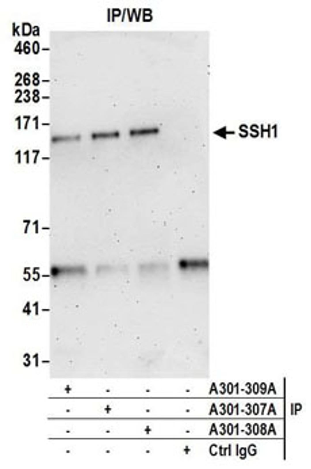 Detection of human SSH1 by western blot of immunoprecipitates.