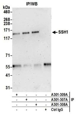 Detection of human SSH1 by western blot of immunoprecipitates.