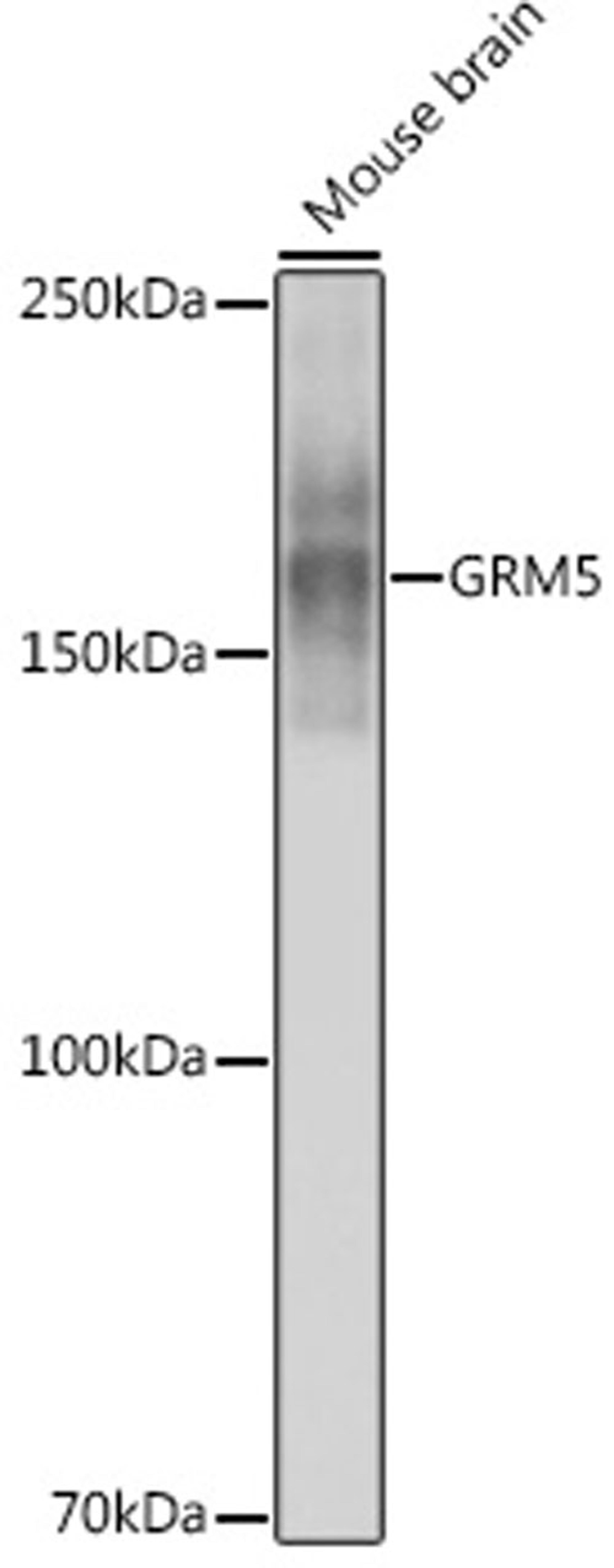 Western blot - GRM5 antibody (A3758)