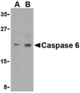 Western blot analysis of Caspase-6 in MCF7 cell lysate with Caspase-6 antibody (IN) at (A) 1 and (B) 2 μg/mL.