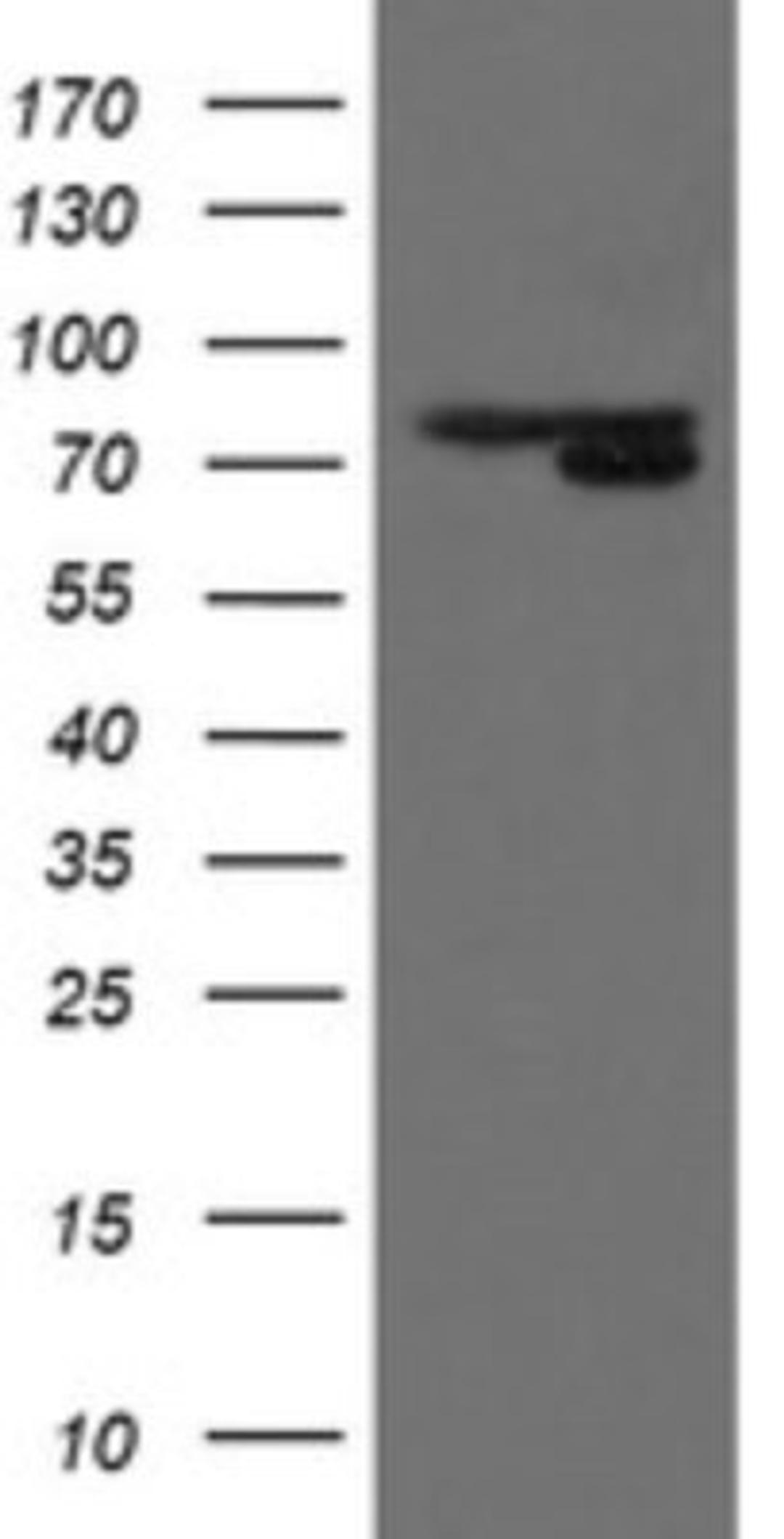 Western Blot: MIPEP Antibody (5E7) [NBP2-45861] - Analysis of HEK293T cells were transfected with the pCMV6-ENTRY control (Left lane) or pCMV6-ENTRY MIPEP.