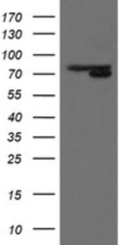 Western Blot: MIPEP Antibody (5E7) [NBP2-45861] - Analysis of HEK293T cells were transfected with the pCMV6-ENTRY control (Left lane) or pCMV6-ENTRY MIPEP.