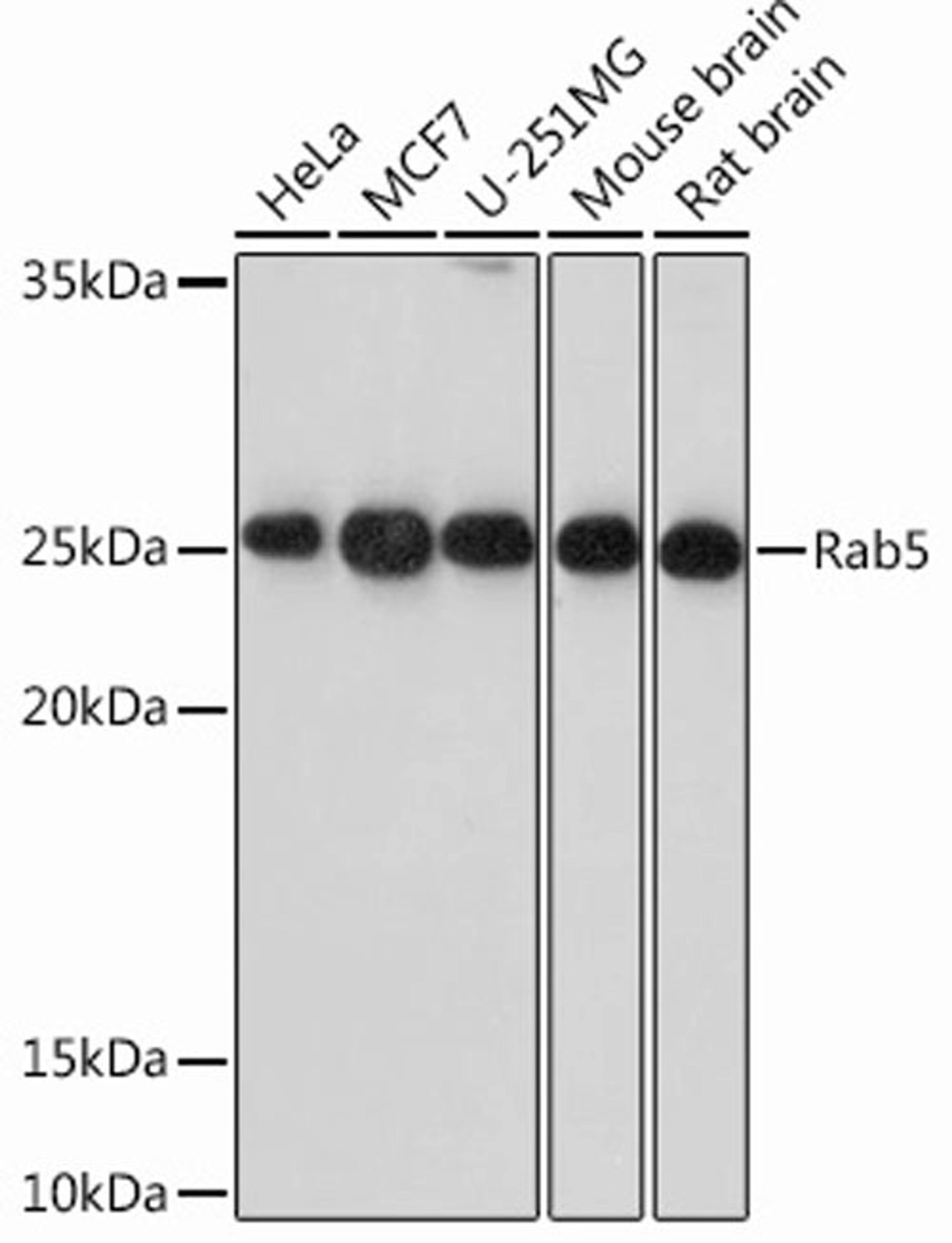 Western blot - Rab5 Rabbit mAb (A12304)