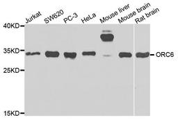 Western blot analysis of extracts of various cells using ORC6 antibody