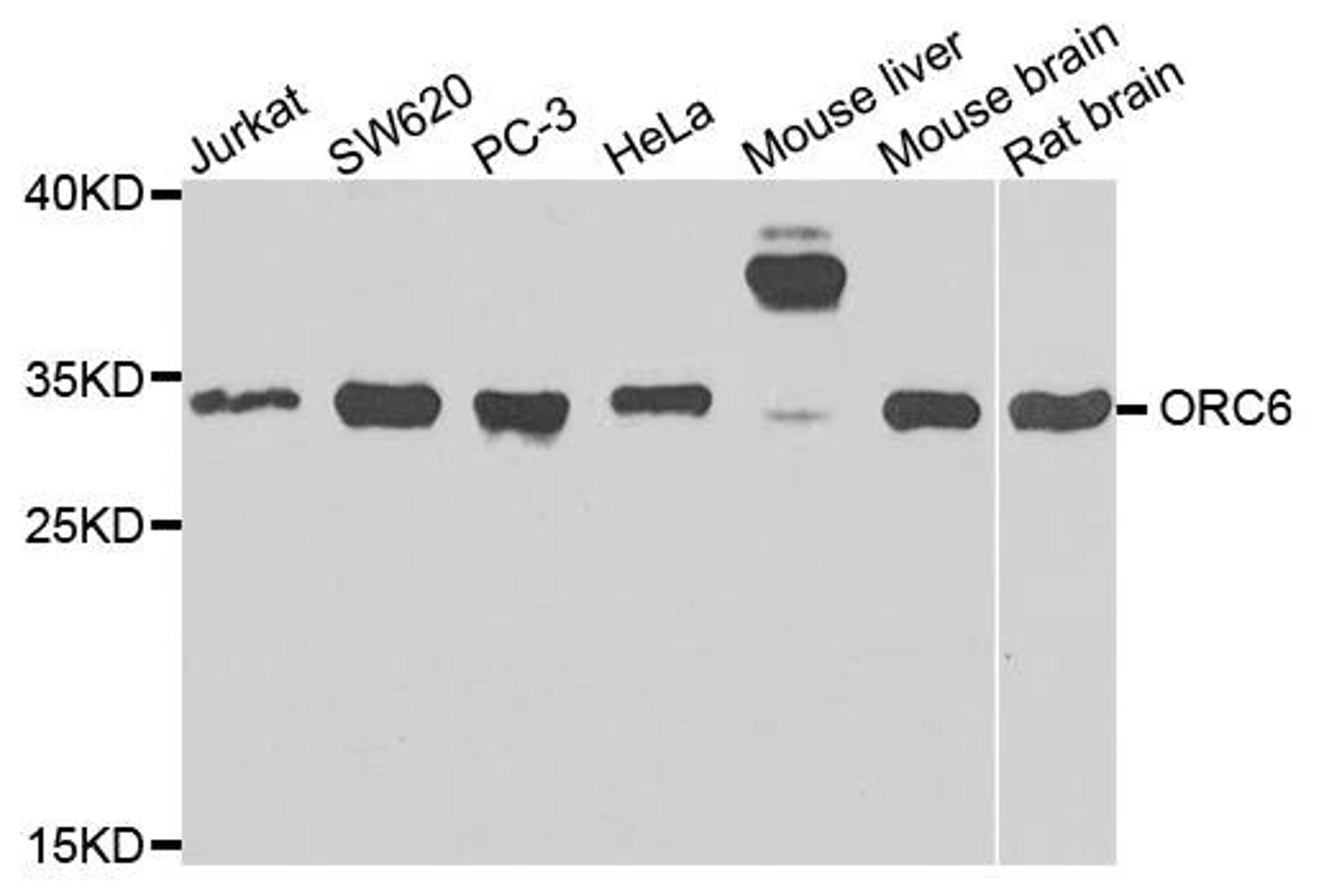 Western blot analysis of extracts of various cells using ORC6 antibody