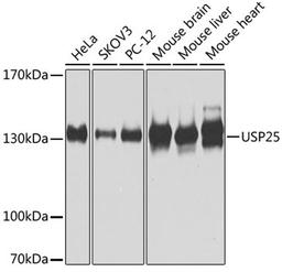 Western blot - USP25 antibody (A7975)