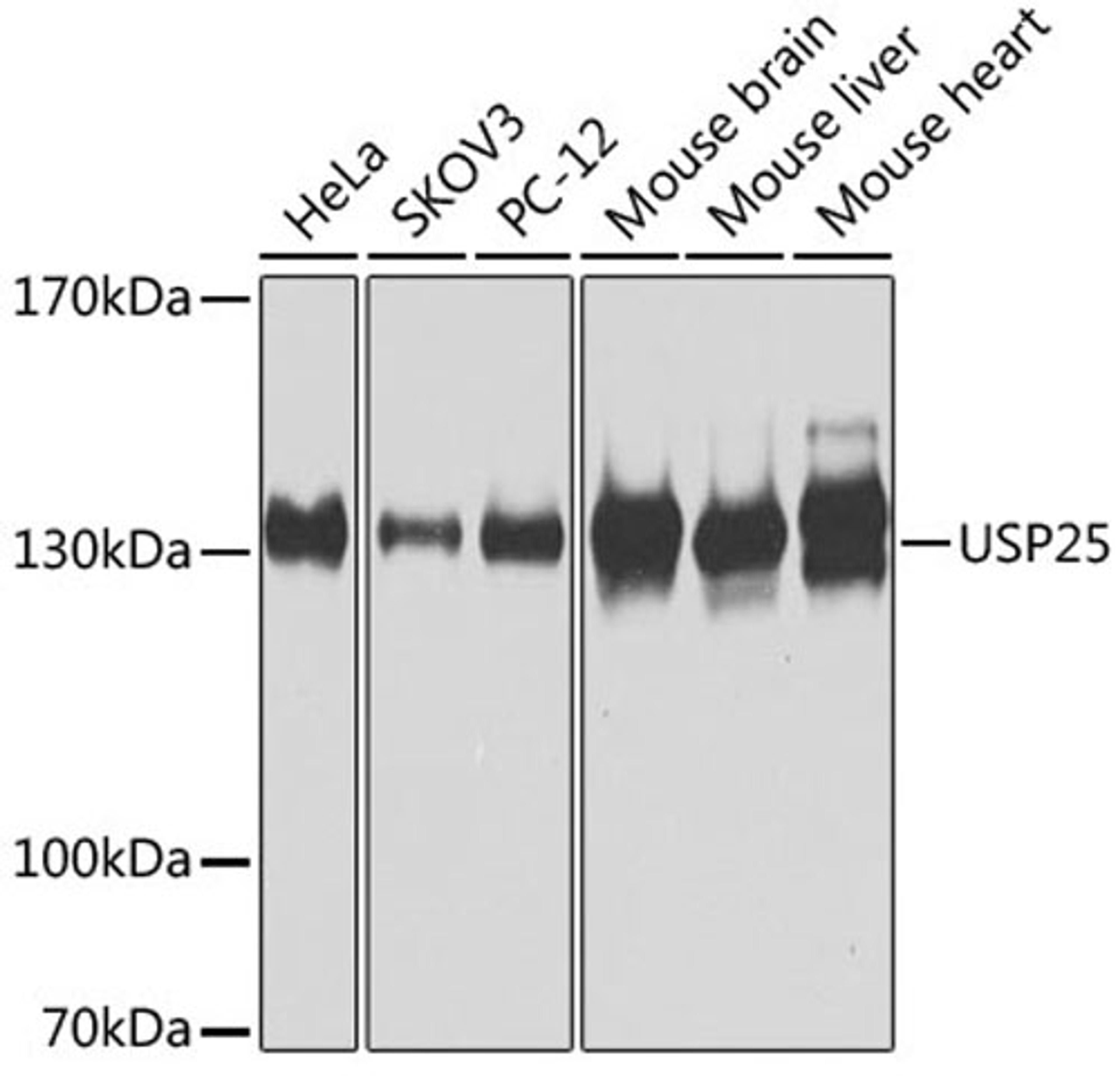 Western blot - USP25 antibody (A7975)