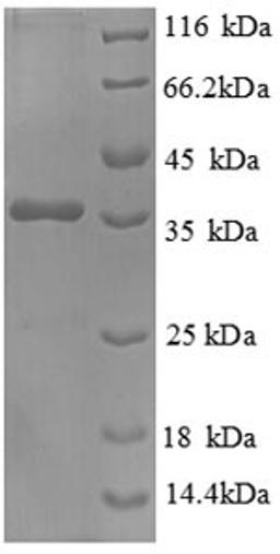 (Tris-Glycine gel) Discontinuous SDS-PAGE (reduced) with 5% enrichment gel and 15% separation gel.