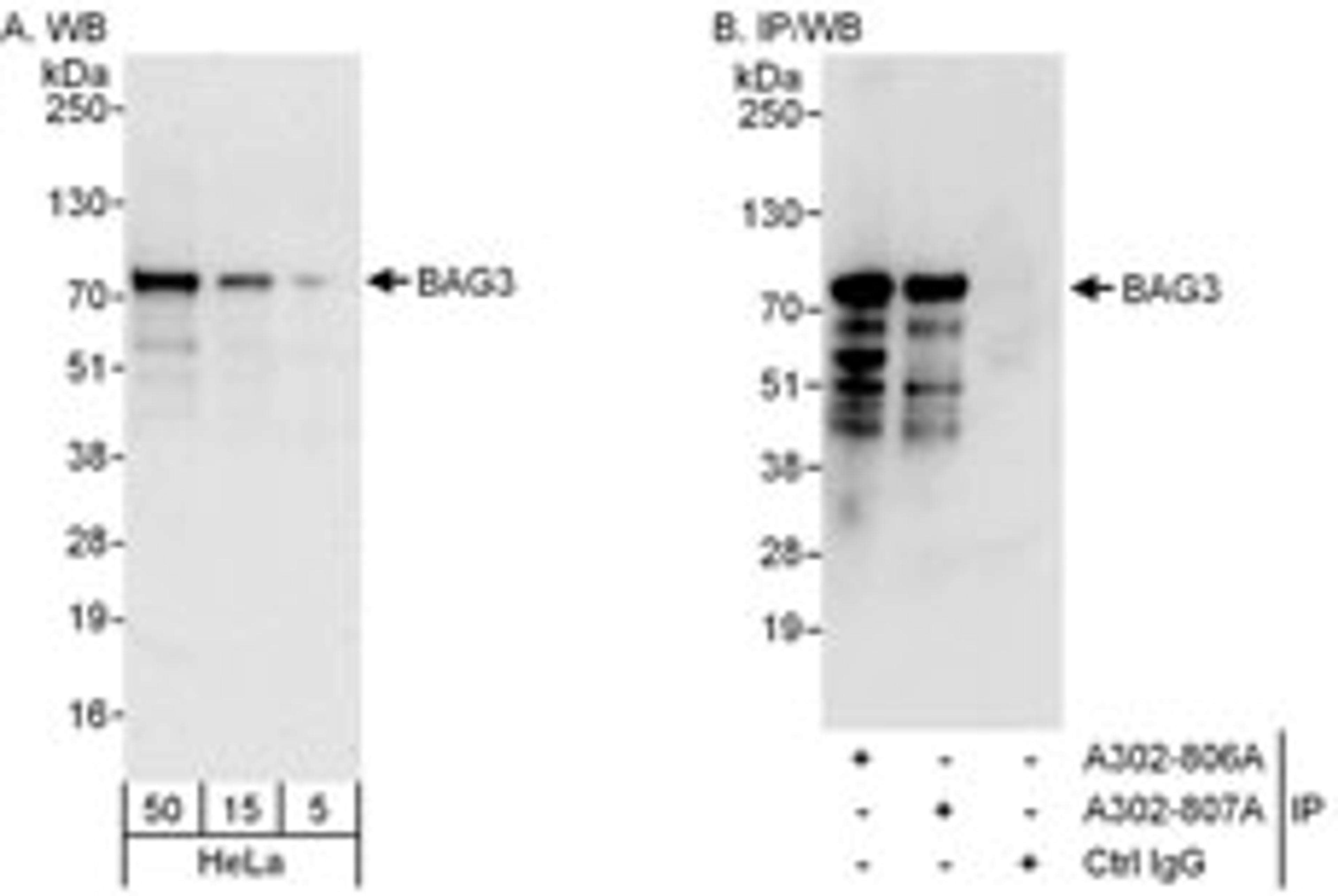 Detection of human BAG3 by western blot and immunoprecipitation.