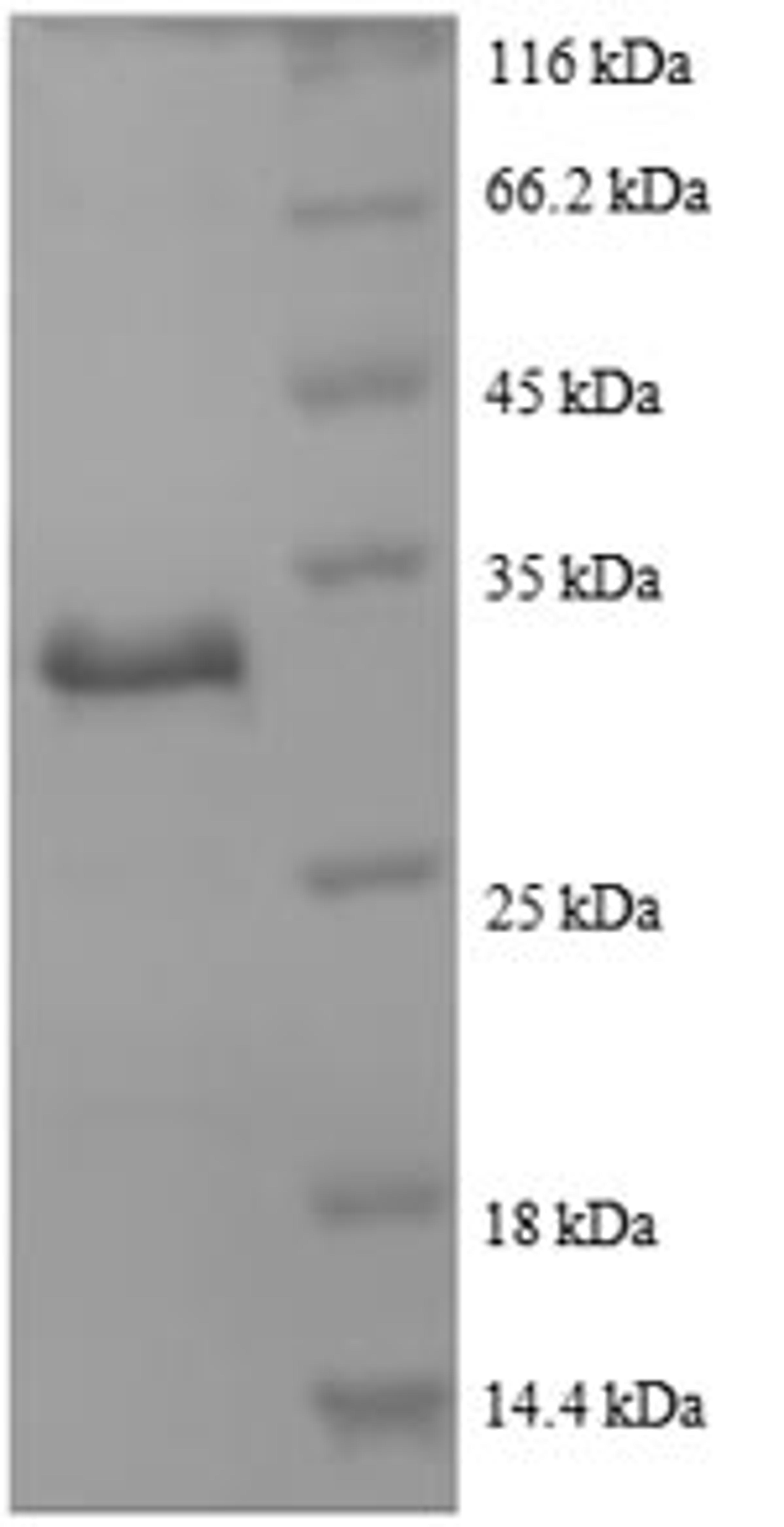 (Tris-Glycine gel) Discontinuous SDS-PAGE (reduced) with 5% enrichment gel and 15% separation gel.