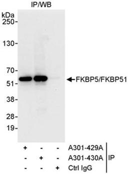 Detection of human FKBP5/FKBP51 by western blot of immunoprecipitates.