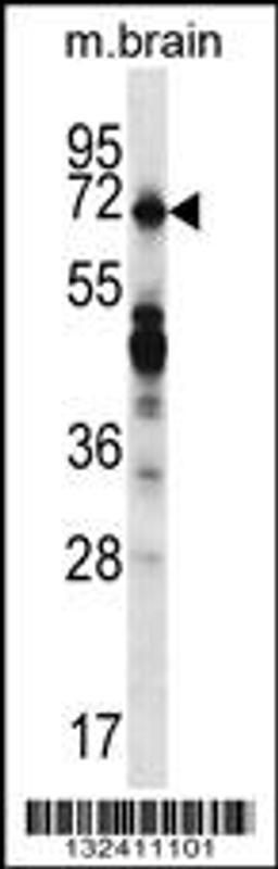 Western blot analysis in mouse brain tissue lysates (35ug/lane).