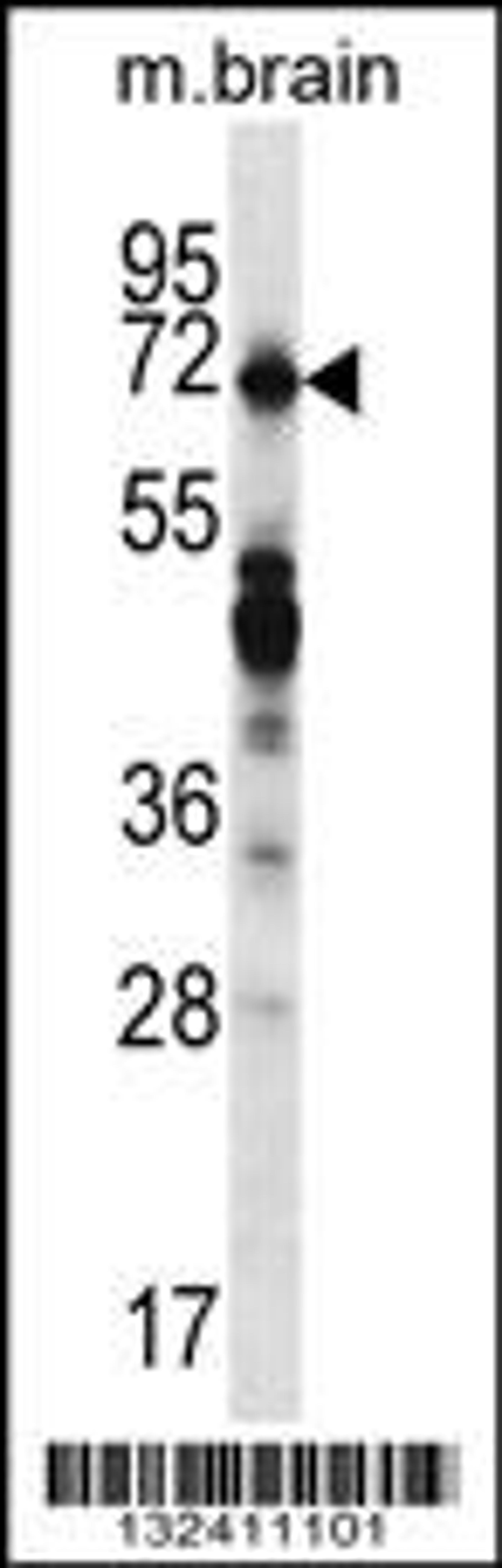 Western blot analysis in mouse brain tissue lysates (35ug/lane).