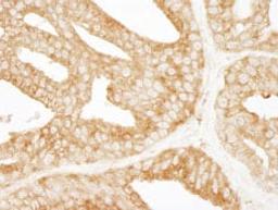 Detection of human EPS15 by immunohistochemistry.