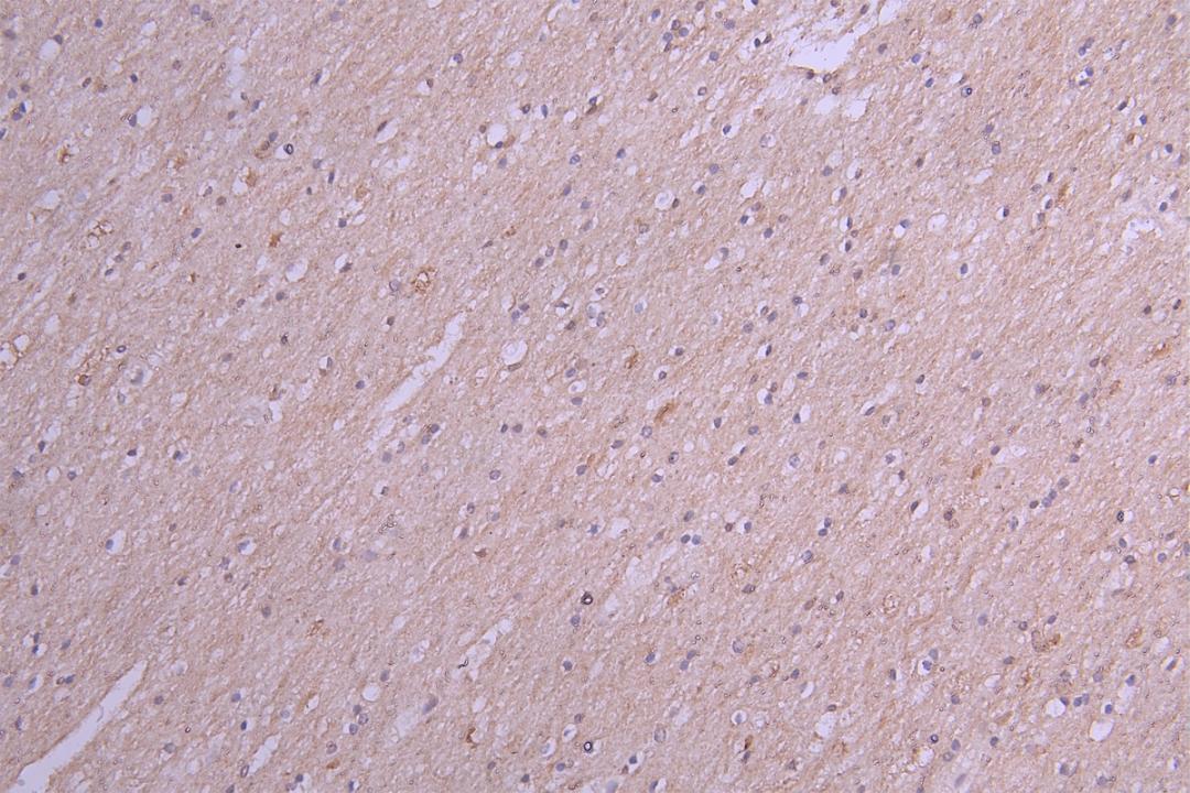 IHC image of CSB-RA867113MA1HU diluted at 1:100 and staining in paraffin-embedded human brain tissue performed on a Leica BondTM system. After dewaxing and hydration, antigen retrieval was mediated by high pressure in a citrate buffer (pH 6.0). Section was blocked with 10% normal goat serum 30min at RT. Then primary antibody (1% BSA) was incubated at 4°C overnight. The primary is detected by a Goat anti-Human IgG labeled by HRP and visualized using 0.05% DAB.
