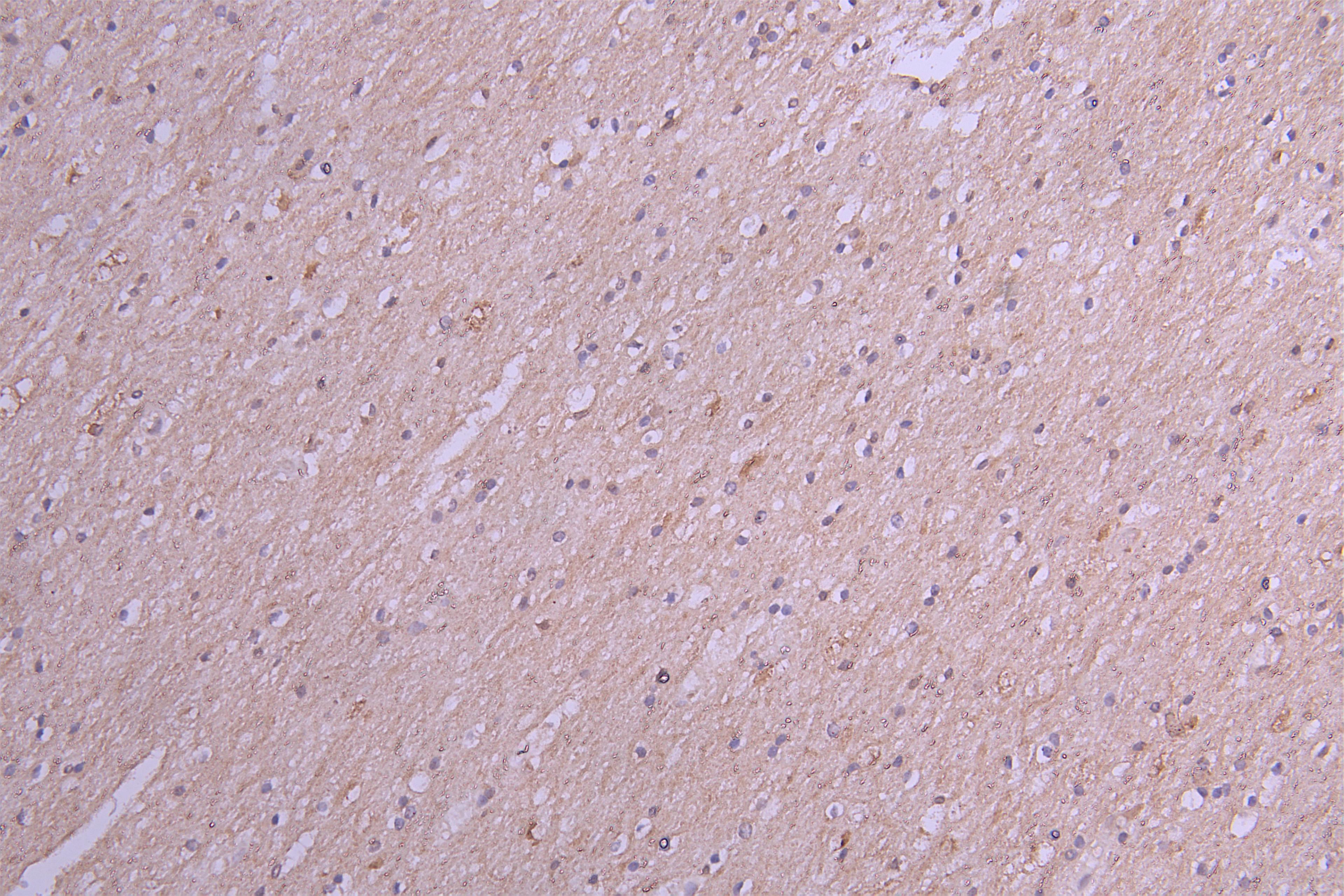 IHC image of CSB-RA867113MA1HU diluted at 1:100 and staining in paraffin-embedded human brain tissue performed on a Leica BondTM system. After dewaxing and hydration, antigen retrieval was mediated by high pressure in a citrate buffer (pH 6.0). Section was blocked with 10% normal goat serum 30min at RT. Then primary antibody (1% BSA) was incubated at 4°C overnight. The primary is detected by a Goat anti-Human IgG labeled by HRP and visualized using 0.05% DAB.