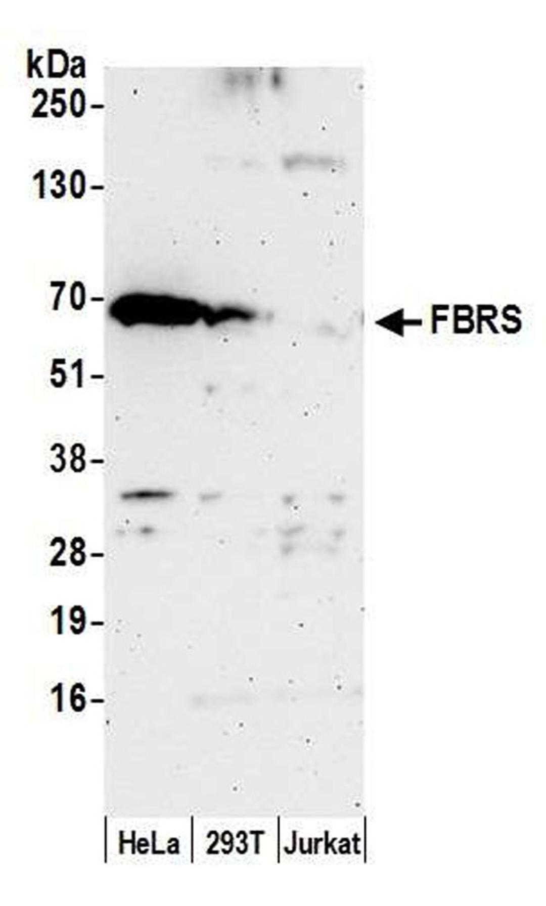 Detection of human FBRS by WB.