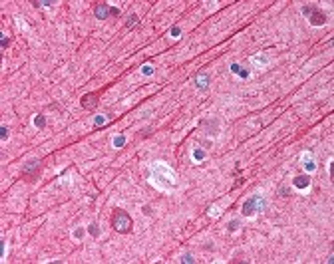 Immunohistochemistry staining of in brain cortex tissue using Antibody.