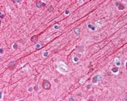 Immunohistochemistry staining of in brain cortex tissue using Antibody.