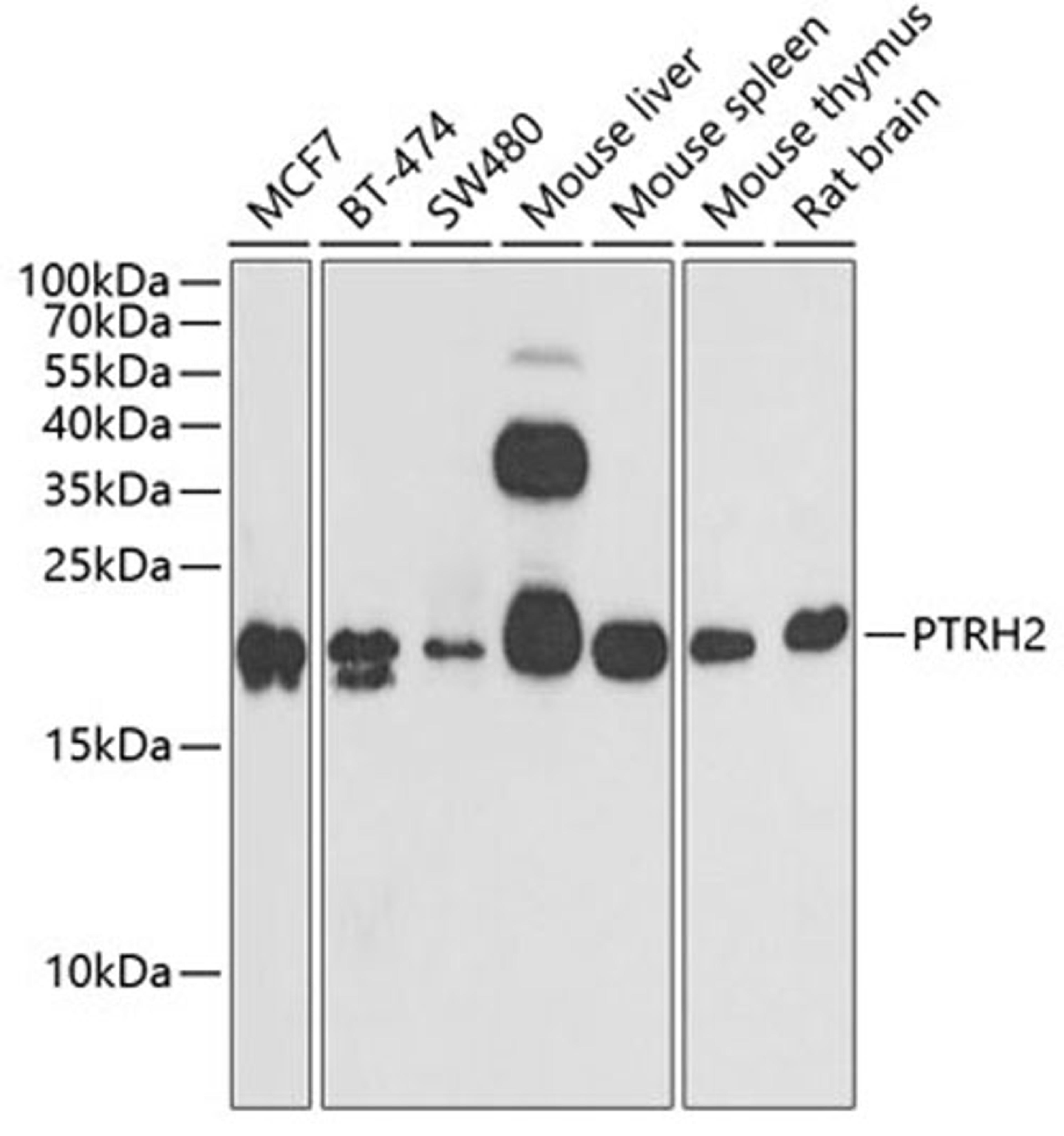 Western blot - PTRH2 antibody (A6466)