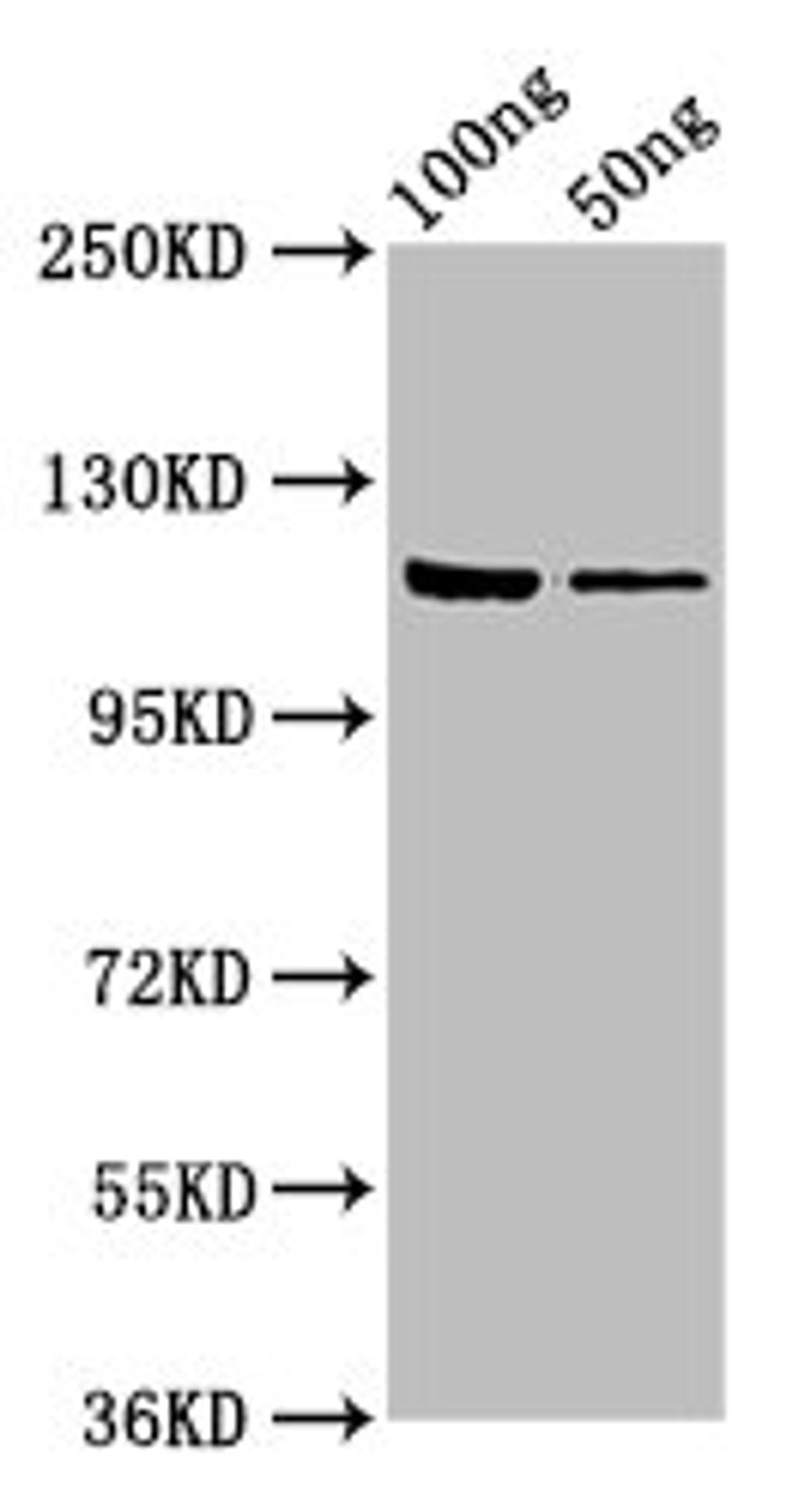 Western Blot. Positive WB detected in: Recombinant protein. All lanes: lacZ antibody at 7.5ug/ml. Secondary. Goat polyclonal to rabbit IgG at 1/50000 dilution. Predicted band size: 117 kDa. Observed band size: 117 kDa. 