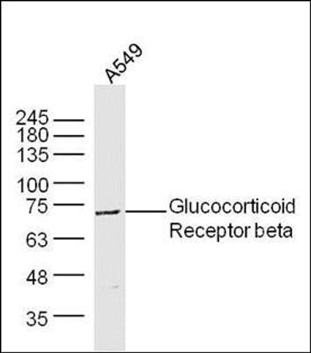 Western blot analysis of extracts from A549 cells using Glucocorticoid Receptor beta antibody. 